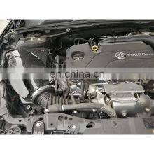 Discounts High Strength Car Accessories Dry Carbon Fiber Air Intake Kit Filter For BUICK REGAL GS 2.0T thumbnail-5