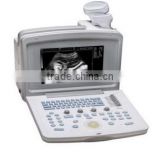 Full Digital B&W Portable Portable Ultrasound Scanne