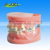 Orthodontic Teeth Model(malocclusion Teeth)/dental Orthodontic Models thumbnail-1