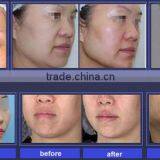 YUWEI Portable Hifu Face Lift and Corporal thumbnail-6