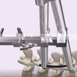 Spine Retractors, Neurosurgery Instruments, Spinal Surgery Distractor thumbnail-6