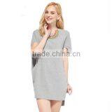 2016 New Season Elegant Style Casual Fastion Dress for Woman Dresses thumbnail-2