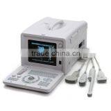 Hot Seller Full Digital Portable Ultrasound Scanner RUS-6000D With Convex Microconvex Probe thumbnail-6