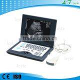 LTS5800 Medical Best Ultrasound Machine Sale