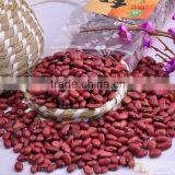 Red Kidney Beans for Hot Sale and With Free Sample for Sale thumbnail-2