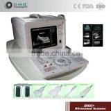 Portable Digital Ultrasound Scanner With SVGA Screen Transvaginal + Convex Probe 200C+ thumbnail-5