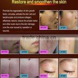 NEWEST! Face Whitening Acne Scar Treatment and Pimple Removal Cream thumbnail-4