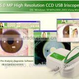 5MP high resolution iris Iriscope analysis