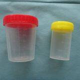 Plastic Injection Mold for Urine Cup, Plastic Mold Maker thumbnail-3
