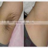 Supply Medical Affordable Permanent Hair Removal / at Home Laser Hair Removal Machines Keyword thumbnail-6