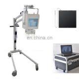 China High Quality MY-D019D Hospital Safeway Mobile X-ray System With Wheels thumbnail-2