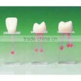 Tooth root canal model S7