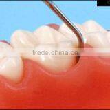 Dental Education Treating Periodontal Diseases for Teaching thumbnail-4
