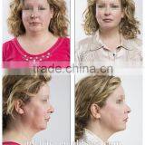 Portable PDT Skin Whitening Ultrasonic Facial Lifting Equipment - CE thumbnail-6