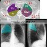 Imaging medical ray film,digital x-ray cr,fuji x-ray film sale from factory in hanghzou
