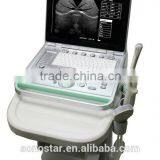 V7 Veterinary Ultrasound Vet Laptop Veterinary Radiology & Ultrasound Machine China thumbnail-3