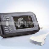 Handheld Ultrasound Scanner HandScan H8 thumbnail-1