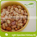 Edible Light Speckled Kidney Beans For Canning thumbnail-1