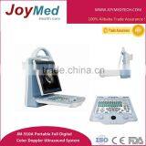 Prostate Health Portable Color Doppler Ultrasound Scanner thumbnail-1