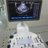 Trolly 2D Echocardiography Color Doppler Ultrasound Scanner thumbnail-2