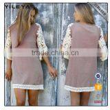 Lace Design Half Sleeve Dress,shift Dresses,casual Shift Dresses thumbnail-1