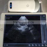 Best Price Pocket Ultrasonic Diagnostic Wireless Ultrasound Probe 10 Years Export Experience Supplier -WBU01 thumbnail-4