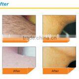 2000W 808nm Diode Laser Hair Removal Machine For Permanent Hair Removal 10-1400ms thumbnail-6