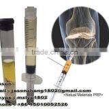 High Concentrate Platelet Price Plasma Centrifugation Prp Kit thumbnail-3