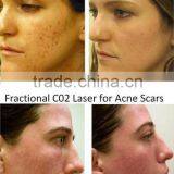 Rf Fractional Needle/rf Excited Co2 Fractional Laser/fractional rf thumbnail-5