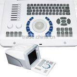 CE Approved Full Digital LCD Display Diagnostic Laptop Ultrasound Scanner thumbnail-2