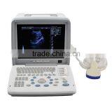 Factory Price Hospital Device Medical Full Digital Imaging Technology 12-inch Human Ultrasound Machine thumbnail-3