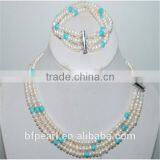Button Freshwater Pearl and Turquoise Necklace With Pearl Bracelet Set thumbnail-1