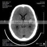 Imaging Medical Ray Film,digital X-ray Cr,agfa Dry Film Sale From Chinese Manufacturer thumbnail-1