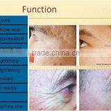 2016 Spring Promotion! Micro Needle RF Scar / Wrinkle Removal / Face Lift Fractional RF thumbnail-6