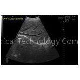 3.5MHz Convex Probe Digital Portable / Mobile / Laptop Ultrasound Scanner BIO 3000M thumbnail-1