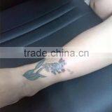 Q Switched Laser Machine Sanhe 2 Years Warranty 1064 Nm 532nm Nd Yag Laser Haemangioma Treatment / Q-switch Nd:yag Laser Tattoo Removal/tattoo Laser Removal Machine Freckles Removal thumbnail-6