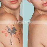 Distributors Wanted Machine for Small Business at Home Laser Tattoo Removal / Pigmentation Removal q Switch nd Yag Laser Machine thumbnail-6