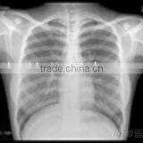 X-ray Film From Manufacturer,medical Dry Film Used on Fuji and Agfa Printers thumbnail-1