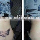 Portable Tattoo Removal Q-switch1064 nm 532nm nd Yag Laser Machine for Home Use thumbnail-5