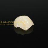 Dental Crown E.Max Ceramic, Porcelain Crown, Dental Veneers, Laboratoire Dentaire, Dentallabor, Laboratorio Dental, Dental Laboratory, Shenzhen LJ Dental Lab China thumbnail-4