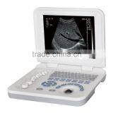 Vet Ultrasound/10.8" LED Display 3D Cheap Professional Animals Use Portable Ultrasound thumbnail-3