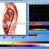 *2015*health Clubs Equipments,Money Maker Newest Health Analyzer thumbnail-2