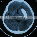 China Medical Film,high Quality and Low Price,compatible With Fuji and Agfa thumbnail-1