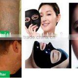 Good Q Switch ND YAG Laser Prices Laser Removal Tattoo Machine Tattoo Removal Laser Machine Naevus Of Ito Removal thumbnail-4