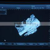 3D Portable Ultrasound Scanner for Vet Use With Low Price thumbnail-3