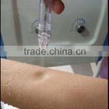 Perfect Acne Treatment Oxygen Jet Peel Oxygen Peel Skin Rejuvenation thumbnail-6