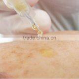 Platelet Rich Plasma PRP Tube thumbnail-5