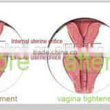 15W(20W) Fractional CO2 Laser Machine Surgical Treatment 8.0 Inch Vaginal Tightening Better Than Vaginal Lubricants thumbnail-5