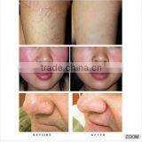 980nm Diode Laser Red Blood Removal/diode Laser 980nm Varicose Vein Removal thumbnail-6