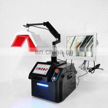 Led 650nm Laser Diode Hair Regrowth With Hair Follicle Detection Beauty Machine Anti Hair Loss Treatment Scalp Care System thumbnail-4